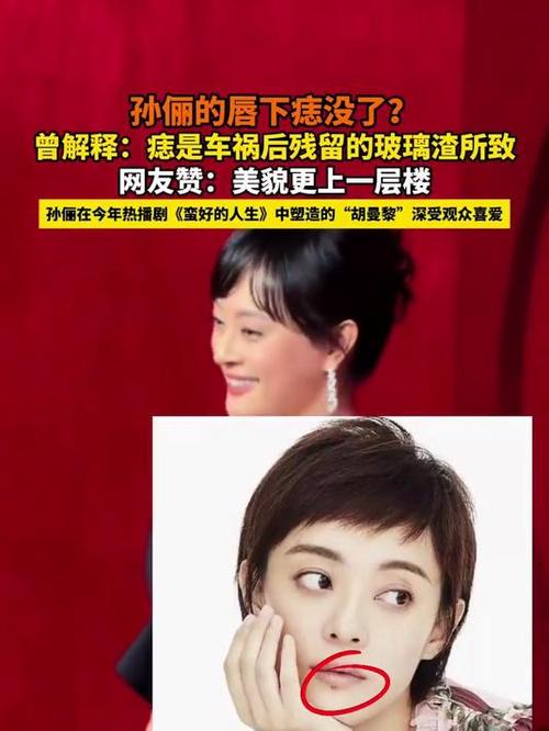 2025澳门天天彩开奖结果查询表和孙俪唇下痣没了与孙俪嘴唇的痣